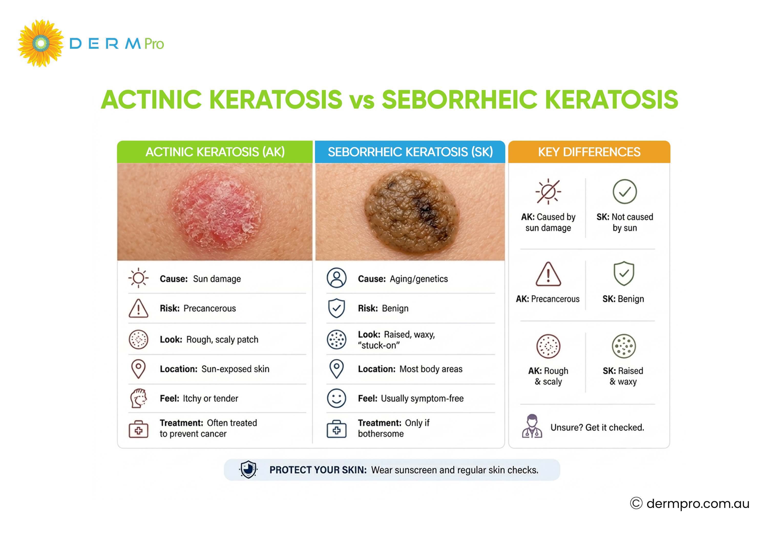 Actinic Keratosis vs Seborrheic Keratosis
